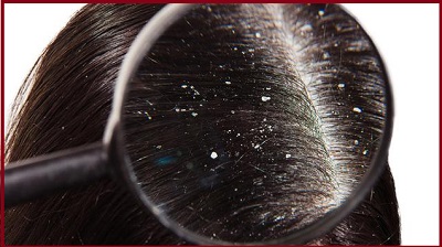 Manfaat Jeruk Nipis untuk Rambut dan Cara Membuat Hair Tonic Alami di Rumah
